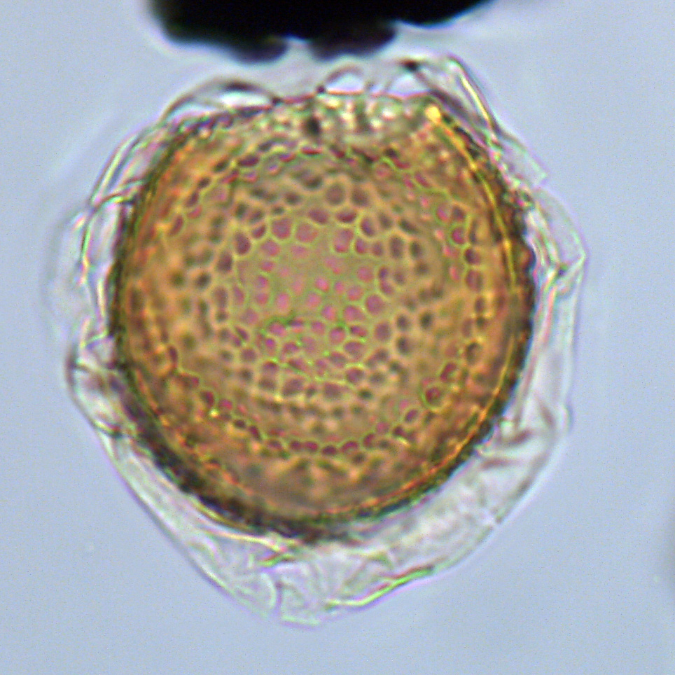 Leberidocysta chlamydata, U1581-28R-6W, 106-110, sl. 1, M35, foto-d.jpg